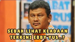 Ramai tak tahan sebak lihat keadaan terkini Ebby Yus [upl. by Nedrob]