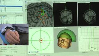 Robotic TMS Motor Mapping Over Predefined Grid [upl. by Atsed468]