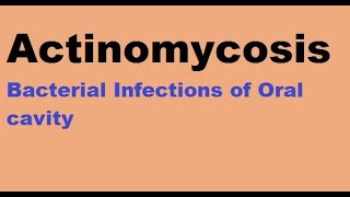 Actinomycosis  Bacterial infections of the oral cavity [upl. by Edmonda134]