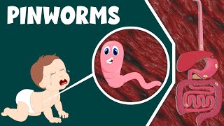 Pinworm Infection Causes and Treatment  Life Cycle of Pinworm  Video for Kids [upl. by Aleehs]