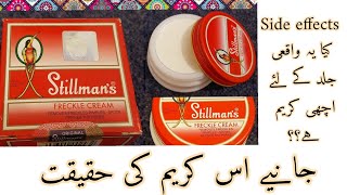 Stillmans freckle cream  Side effects  Honest Review on Stillmans freckle cream [upl. by Adnical]