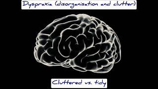 Dyspraxia disorganisation and clutter realistic example [upl. by Buttaro]