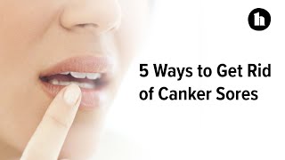 5 Ways to Get Rid of Canker Sores  Healthline [upl. by Birck429]