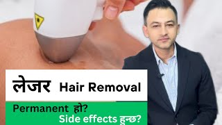 Laser Hair Removal in Nepal  Price Sessions Side effects and more [upl. by Acey22]