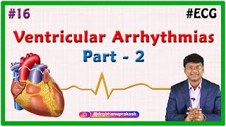 16 Ventricular Arrhythmias Part 2  ECG assessment and ECG interpretation made easy [upl. by Yecats37]