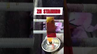 ZN Staining or Ziehl Neelsen staining shorts staining [upl. by Sergias942]