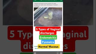 5 types of vaginal discharges endometriosis reproduction vet shorts viral [upl. by Nhar]