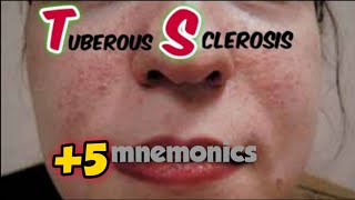 Tuberous Sclerosis Complex TSC  tuberous sclerosis  medicalmnemonics786 [upl. by Nnanerak]