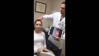 Rhinoplasty for Hanging Columella and Flared Nostrils  Dr Anthony Bared MD FACS Miami FL [upl. by Yellek]