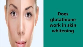 Does Glutathione Work In Skin Whitening [upl. by Song412]