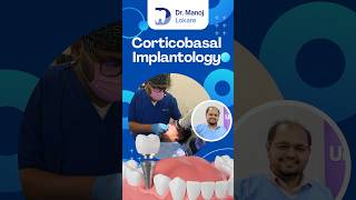 Discover the Power of Corticobasal Implantology  Fix Teeth in 3 Days  Dr Manoj Lokare Thane West [upl. by Richela]