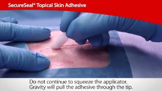 SecureSeal® Topical Skin Adhesive  Cardinal Health [upl. by Idell]