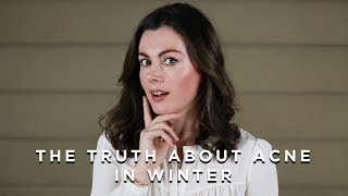 The Truth about Acne in Winter  Dr Sam Bunting [upl. by Pasia]