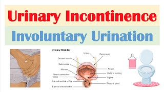 Urinary Incontinence Stress Urge Overflow amp Functional  Causes Symptoms Diagnosis Treatment [upl. by Anirec679]