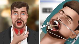 ASMR Animation Remove fish bones stuck in MrBeasts throat [upl. by Frasco294]