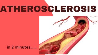 Atherosclerosis in 2 minutes [upl. by Ogilvy]