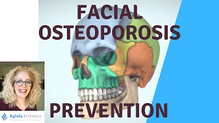 6 WAYS TO PREVENT FACIAL OSTEOPOROSIS Aging Symptoms [upl. by Eanal]