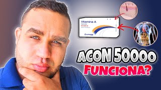 ACON 50000 VITAMINA A RETINOL PARA QUE SIRVE  DEBES SABER ESTO [upl. by Sulohcin706]