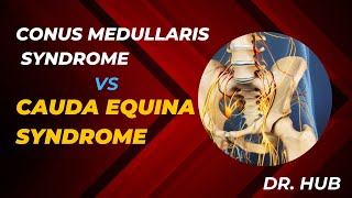 Conus medullaris syndrome vs cauda equina syndrome [upl. by Essex]