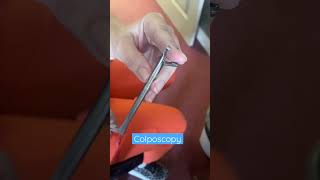 Colposcopy [upl. by Nyvets]