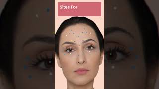 Best treatment for Wrinkles  Botox at Skinaa Clinic shorts viral [upl. by Yalcrab564]