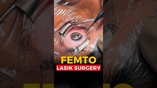 Live Femto Lasik Surgery [upl. by Rory]