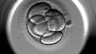 IVF Gynem Klinik  EmbryoScope  Entwicklung des Embryos [upl. by Wassyngton431]