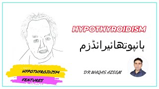 HYPOTHYROIDISM FEATURES [upl. by Necyrb502]