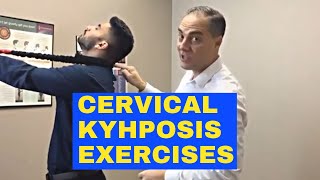 Cervical Kyphosis Exercises Exercises For Reversal Of Cervical Lordosis  Dr Walter Salubro [upl. by Hu]