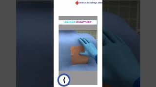 Lumbar Puncture Procedure [upl. by Vasili]