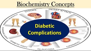 Diabetic Complications pkprabhakar clinicalbiochemistry [upl. by Lebar]