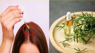 Effects Of Using Rosemary Oil For Hair Growth [upl. by Haseefan]