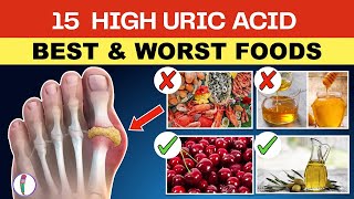 Gout Sufferers Beware 15 High Uric Acid Foods That Can Trigger EXCRUCIATING Pain [upl. by Sophi]