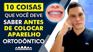 10 COISAS QUE VOCÊ DEVE SABER ANTES DE COLOCAR APARELHO ORTODÔNTICO [upl. by Alaikim]