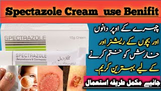 Spectazole cream uses in urdu  Clotrimazole and betamethasone [upl. by Lara881]