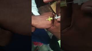 IV Cannula insertion technique shorts​vigo​ लगाना सीखेmedicalstudent​prectice​ timetrending​vi [upl. by Eelaroc]