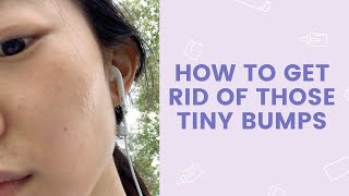 How to Get Rid of Those Tiny Bumps  FaceTory [upl. by Irish]