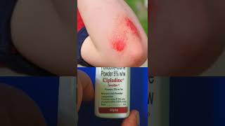 Cipladine Powder review  Povidone Iodine powder pharmatank5632 shorts viral shortvideo [upl. by Ioved]