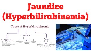 Hyperbilirubinemia  Jaundice  Biochemistry [upl. by Goodard]