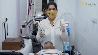 Carbon Laser Peel Treatment  For Deep Brightening of your skin by Dr Swati Tripathi  Mahe Clinic [upl. by Eednim]