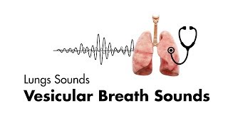 Vesicular Breath Sounds  Normal Lung Sounds  MEDZCOOL [upl. by Gallard]