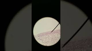 Olfactory nasal epithelium histology [upl. by Oly]