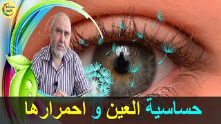 دواء طبيعي لحساسية العين و احمرارها  الدكتور كريم العابد العلوي [upl. by Scurlock442]