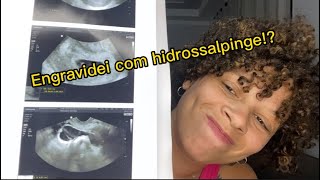 Engravidei mesmo com a hidrossalpinge [upl. by Martina]