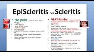 Ophthalmology 150 EpiScleritis Scleritis Difference periodica phenylephrine blanching scleromalacia [upl. by Eulalee]