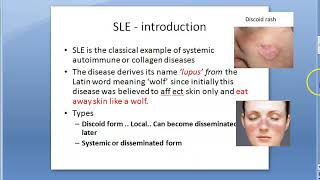 Pathology 078 a Systemic Lupus Erythematosus SLE discoid anti ANA dsDNA smith LE cell Libman [upl. by Donielle]