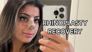 Rhinoplasty Recovery QampA [upl. by Riek]