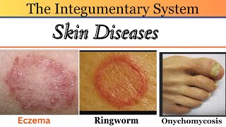 Skin diseases pictures with names  skin disorders and diseases  skin changer atopic dermatitis ⚡⚡ [upl. by Icat]