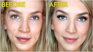 How To Cover Acne Blemishes with Makeup  LeighAnnSays [upl. by Auhs85]