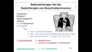 Nebenwirkungen bei der Radiotherapie von Bronchialkarzinomen  Strahlentherapie Prof Hilke Vorwerk [upl. by Nahgrom785]